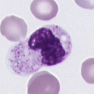 Segmented neutrophil